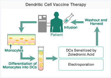 Dendritic Cell Vaccine Therapy