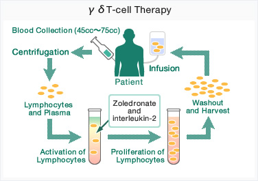 γδT-cell Therapy