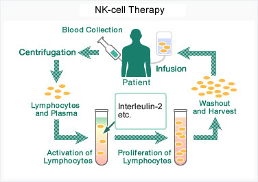 NK-cell Therapy